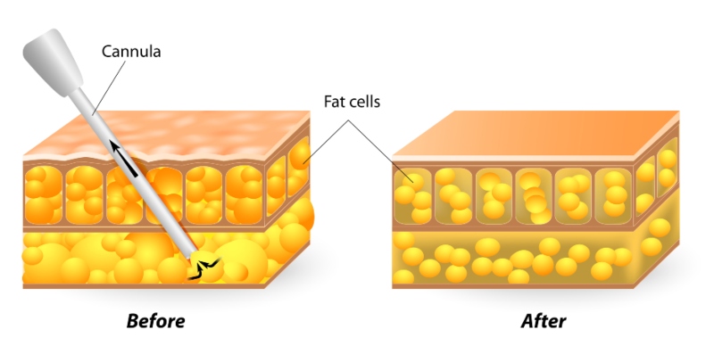 Aesthetic medicine in Turkey