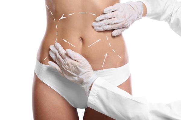 Liposuction surgery in Turkey