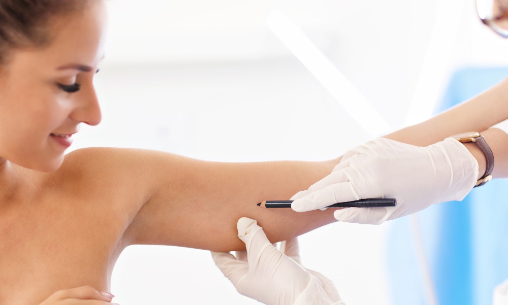 Arm lift in Turkey prices Bookmedi