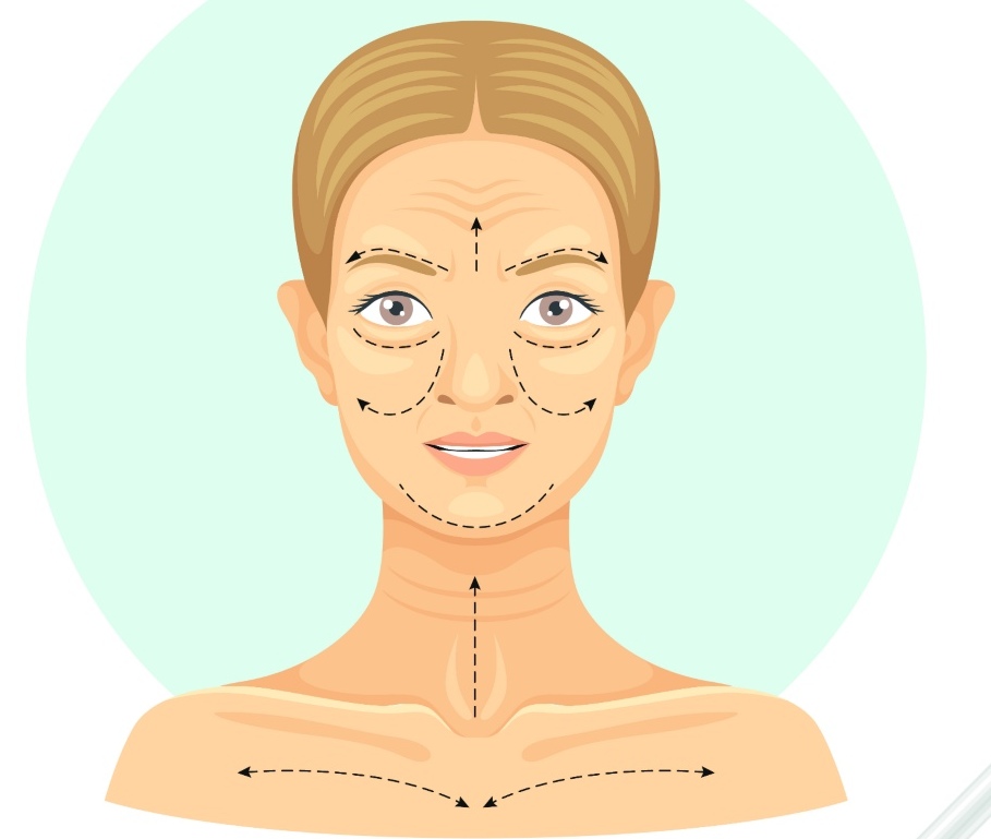 How is Facelift Surgery performed