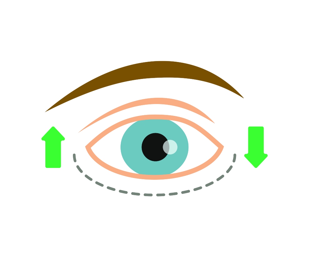 What is an Almond Eye Shape?